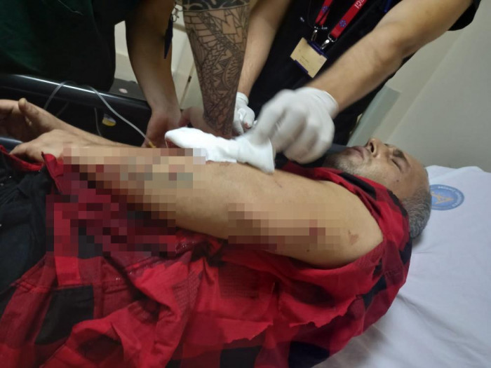 11 aylıkken pitbull saldırısına uğrayan minik Sadrettin, anne kelimesinden önce ‘acıyor’u öğrendi