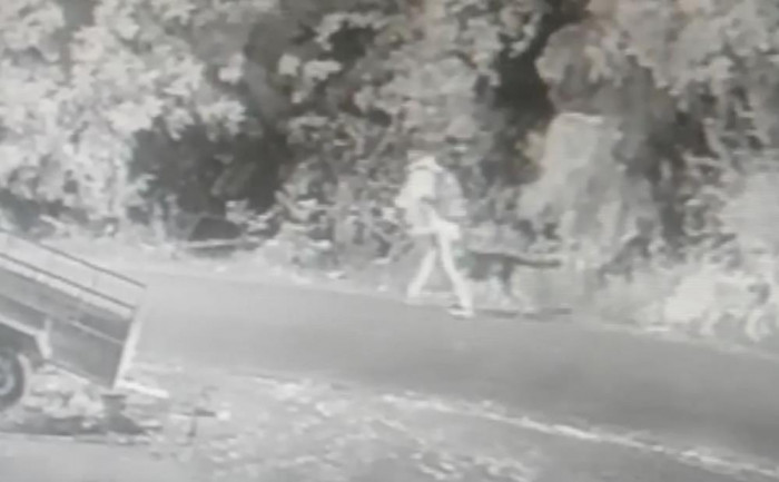 11 aylıkken pitbull saldırısına uğrayan minik Sadrettin, anne kelimesinden önce ‘acıyor’u öğrendi