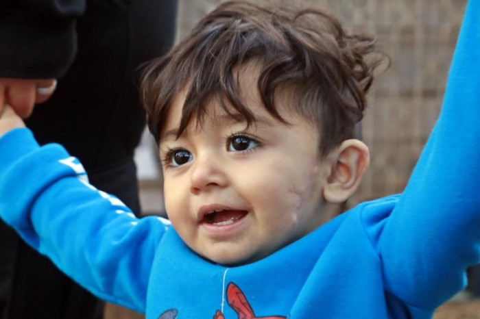 11 aylıkken pitbull saldırısına uğrayan minik Sadrettin, anne kelimesinden önce ‘acıyor’u öğrendi