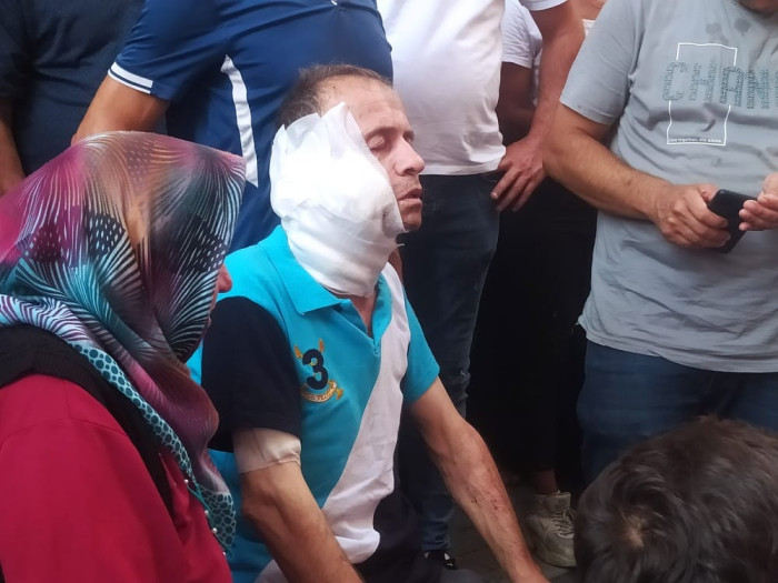 Komşusunun boğazını keserek öldüren genç yakalandı