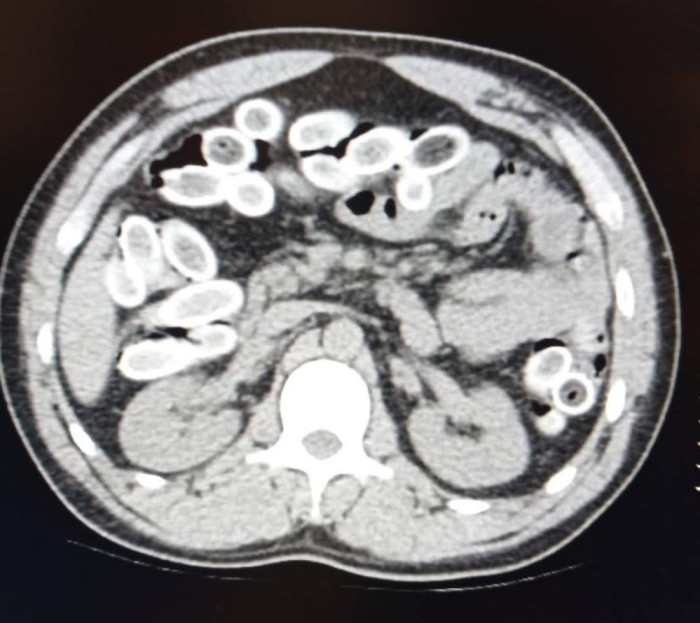  Faslı turistin midesinden 1,5 kilo esrar çıktı