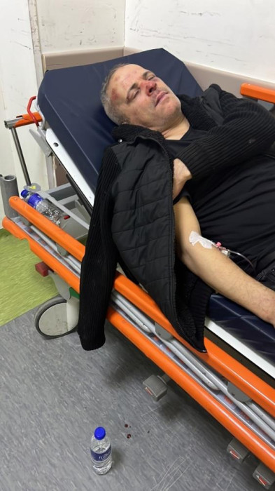 Kendi galerilerinin önünde ölesiye darp edildiler