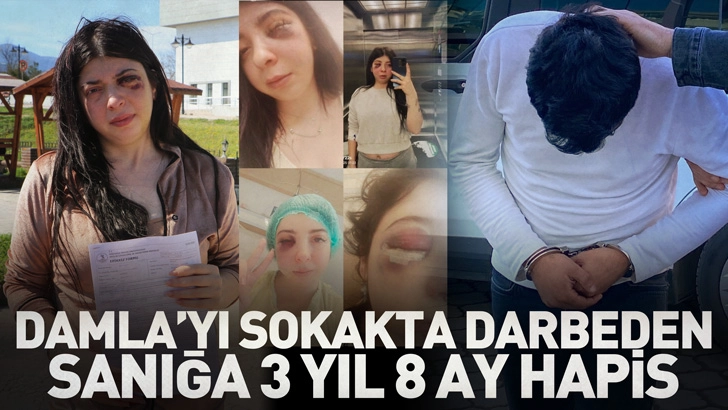Damla'yı sokakta darbeden sanığa 3 yıl 8 ay hapis