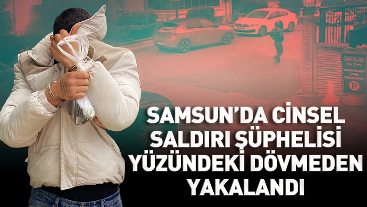 Samsun'da cinsel saldırı ş&uuml;phelisi y&uuml;z&uuml;ndeki d&ouml;vmeden yakalandı