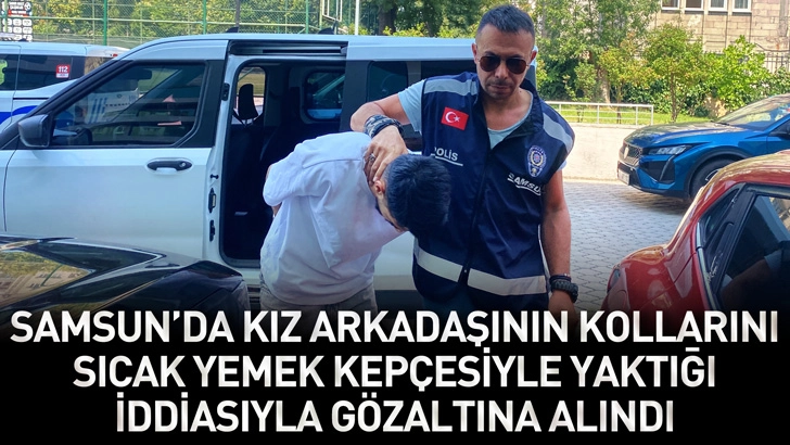 Samsun'da kız arkadaşının kollarını sıcak yemek kep&ccedil;esiyle yaktığı iddiasıyla g&ouml;zaltına alındı